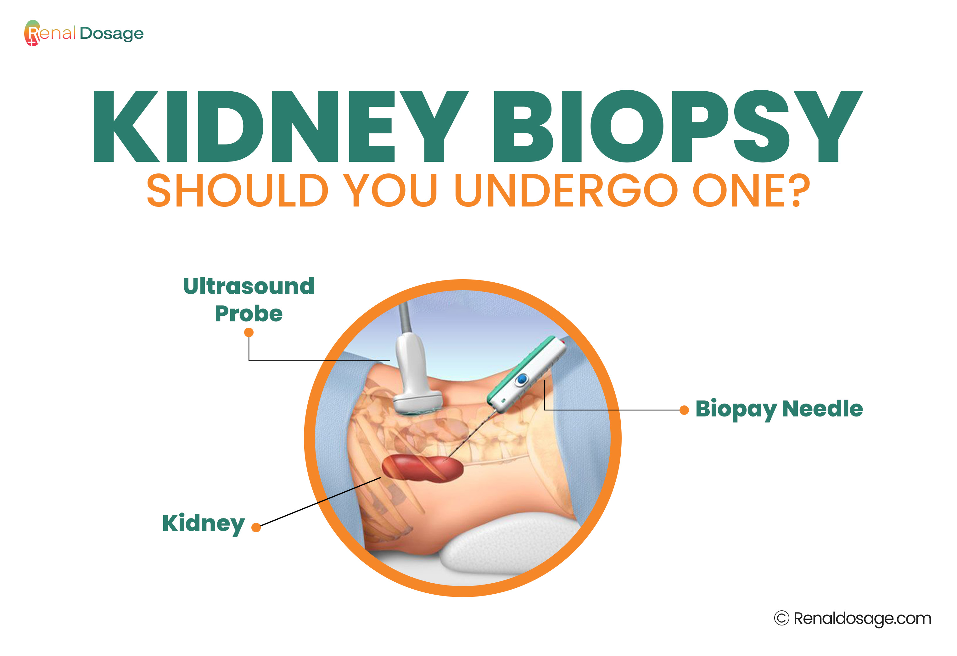  Kidney Biopsy